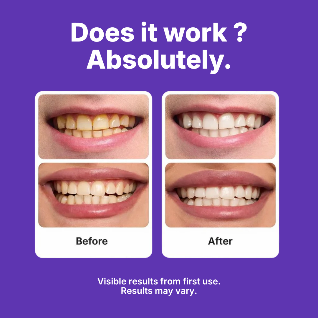 Bryance™ Whitening Strips