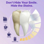 Bryance™ Whitening Strips